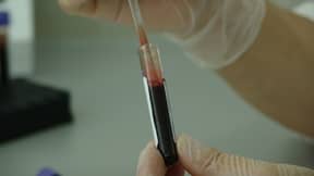 科学家们开发血液测试，可以预测你的死亡
