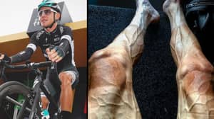 旅游法国骑自行车的人分享他腿的令人震惊的照片