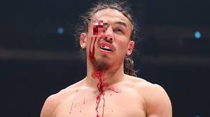 MMA-Fighter Yusuke Yachi在梅威瑟（Mayweather Nasukawa）抓住令人毛骨悚然的眼睛伤害