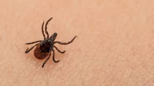 专家警告英国寄生虫可能导致类似疟疾的疾病