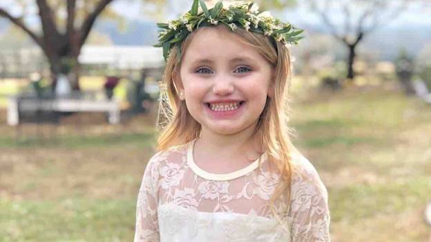 小女孩，六岁，死于四岁哥哥意外击中她的头部