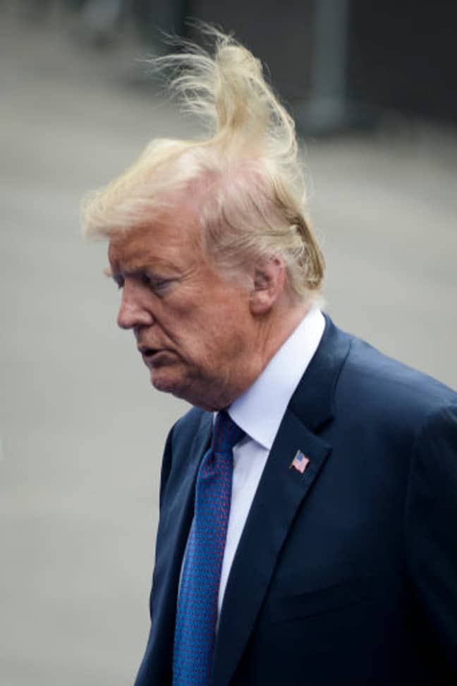 沃尔夫说，总统的头发是染料，喷雾和头皮降低手术的结果。学分：PA