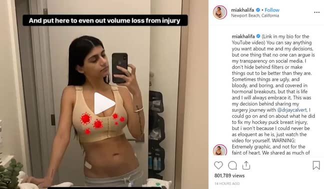 乳房手术后，米娅·哈利法（Mia Khalifa）分享了她的视频博客。学分：Instagram/Miakhalifa