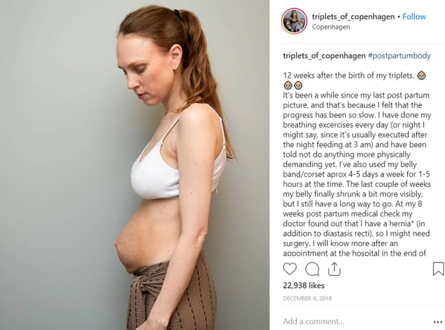 玛丽亚的后胃。学分：Instagram/Mother_of_triplets