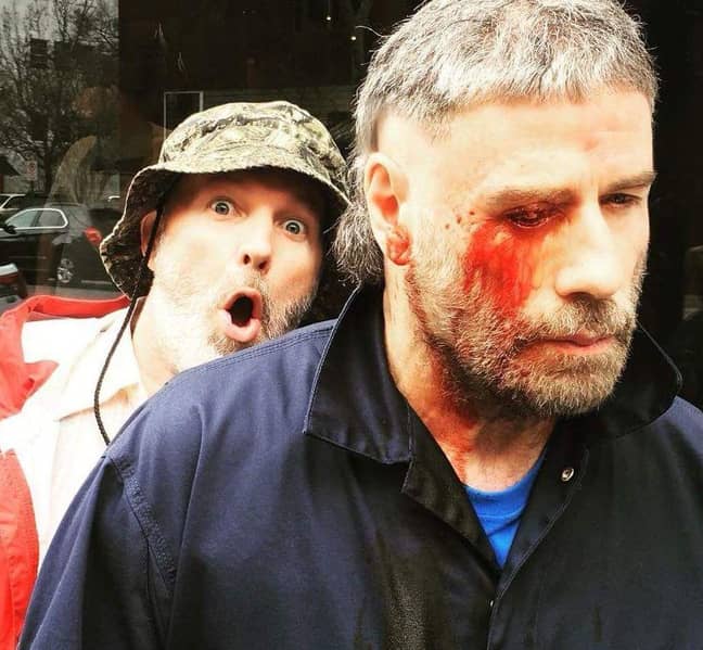 特拉沃尔塔（Travolta）戴着伤口的眼睛。信用：Instagram