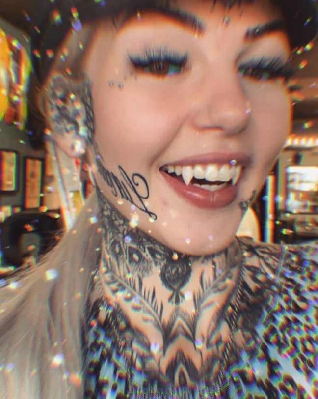 琥珀与她的新牙齿。信用：琥珀路克/ instagram