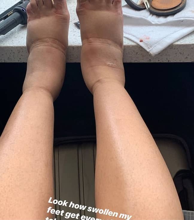 Cardi B在Instagram上透露了她的脚肿胀。学分：Instagram/Cardi b