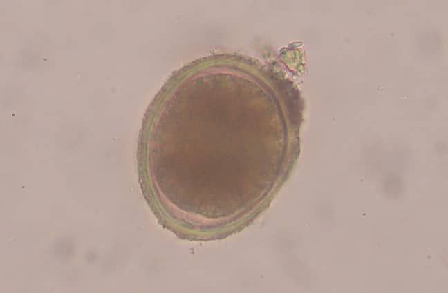 round虫（Toxocara cati）鸡蛋 - 通过显微镜以400倍拍摄的照片。图片来源：乔尔·米尔斯（Wikimedia Commons）