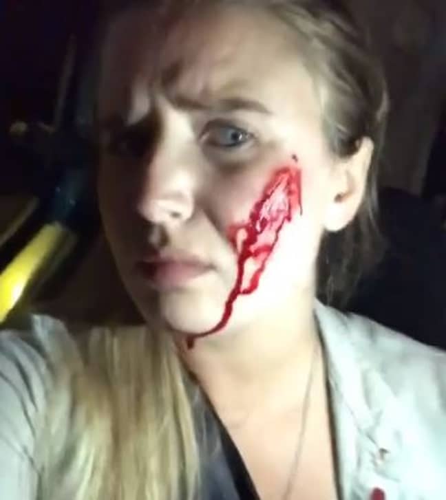 在“射击”后，米娅在她的脸上留下了血液。信用：Instagram / Mythical.mia