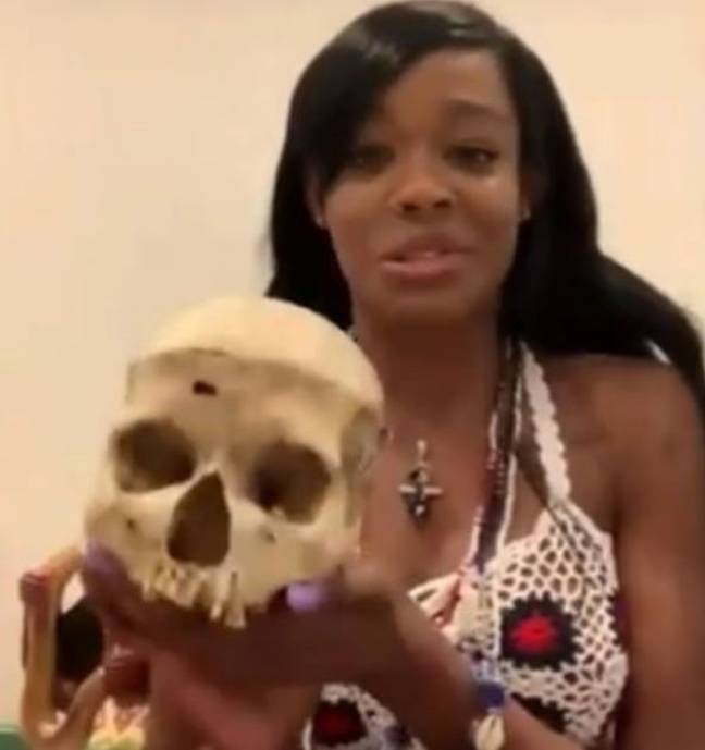 Azealia Banks说她有一个孩子的头骨。信用：KIIS.