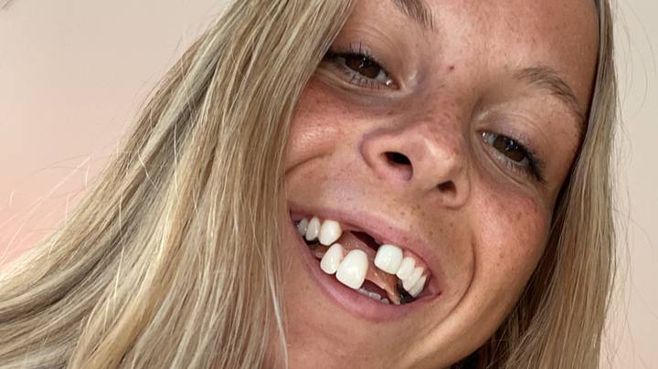 25岁的影响者说，假牙对她的爱情生活产生了负面影响
