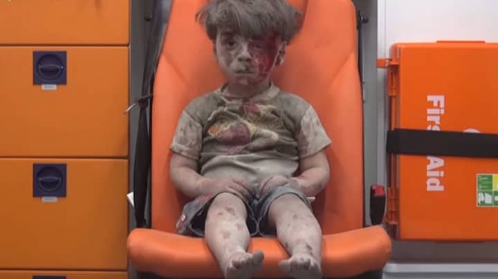 成为Stricken City的象征的Aleppo Boy现在好多了