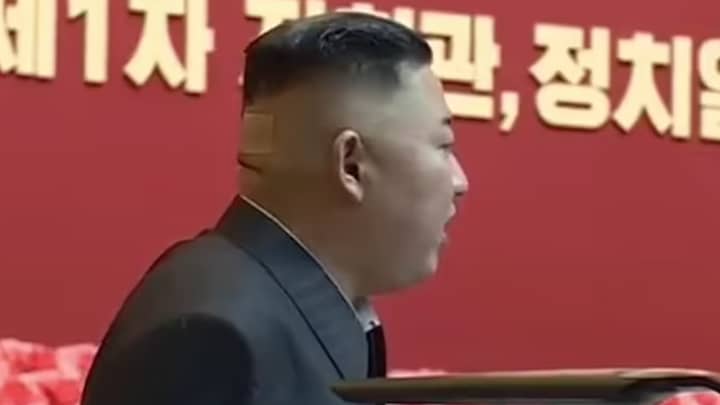 金正恩（Kim Jong-un）在他的头上发现了石膏和深色痕迹