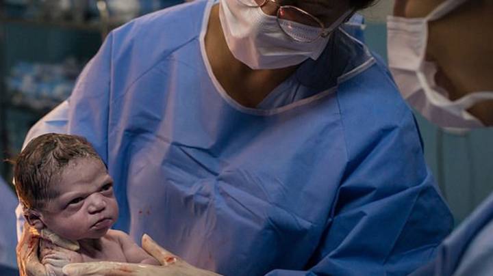 摄影师捕捉到刚出生的婴儿在医生身上皱眉