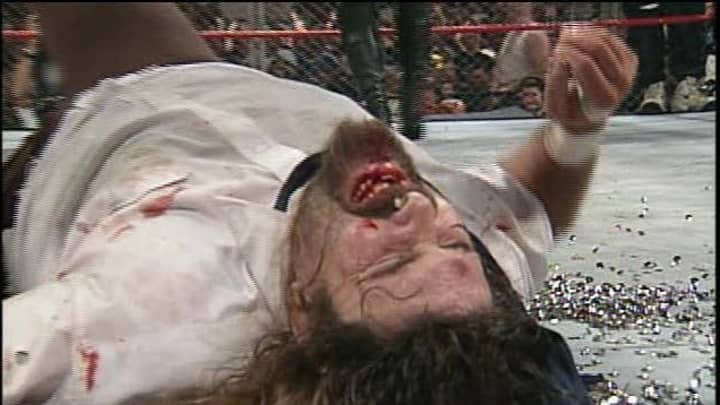 什么是最严重的现实生活中的WWE摔跤伤害？