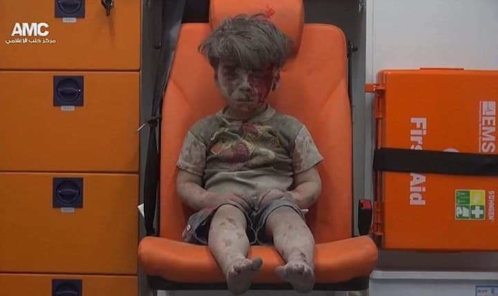 世界上需要看到这个受伤的叙利亚男孩的形象