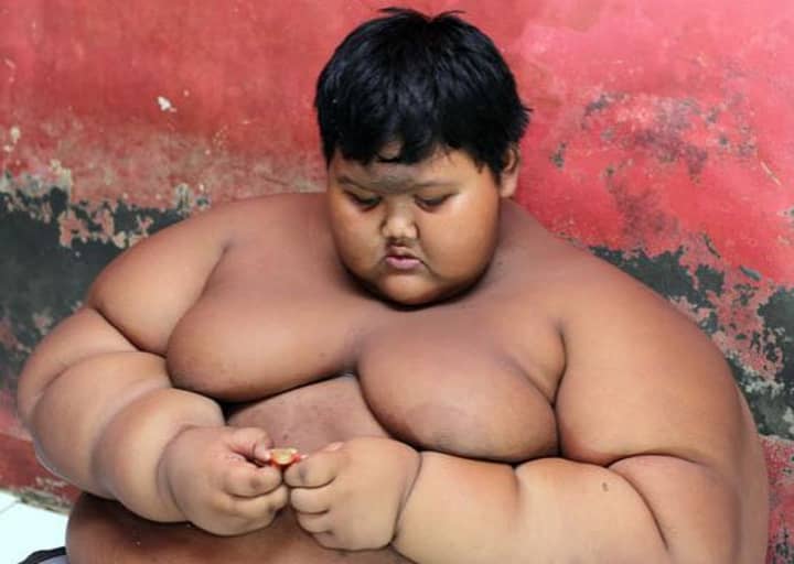 “世界上最胖的孩子”服用狂欢饮食以挽救他的生命